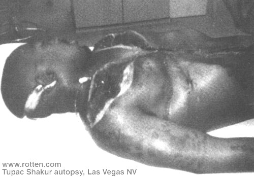 tupac-autopsy (1) (1).jpg
